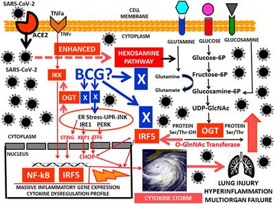 Working Hypothesis for Glucose Metabolism and SARS-CoV-2 Replication: Interplay Between the Hexosamine Pathway and Interferon RF5 Triggering Hyperinflammation. Role of BCG Vaccine?